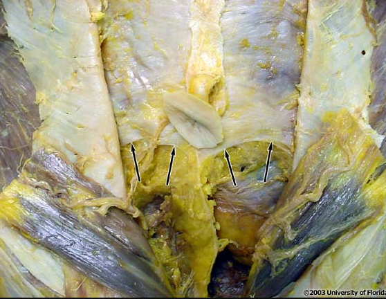 <p>what boundary/margin is indicated in the image (context: on posterior surface of rectus sheath)</p>