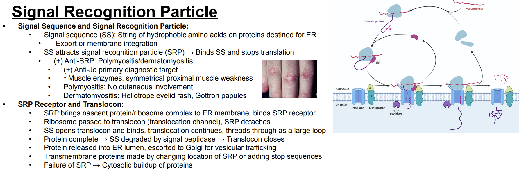 <p>Answer: The signal sequence is degraded by signal peptidase.</p><p>Extra Information:</p><ul><li><p>The translocon then closes.</p></li></ul><p></p>