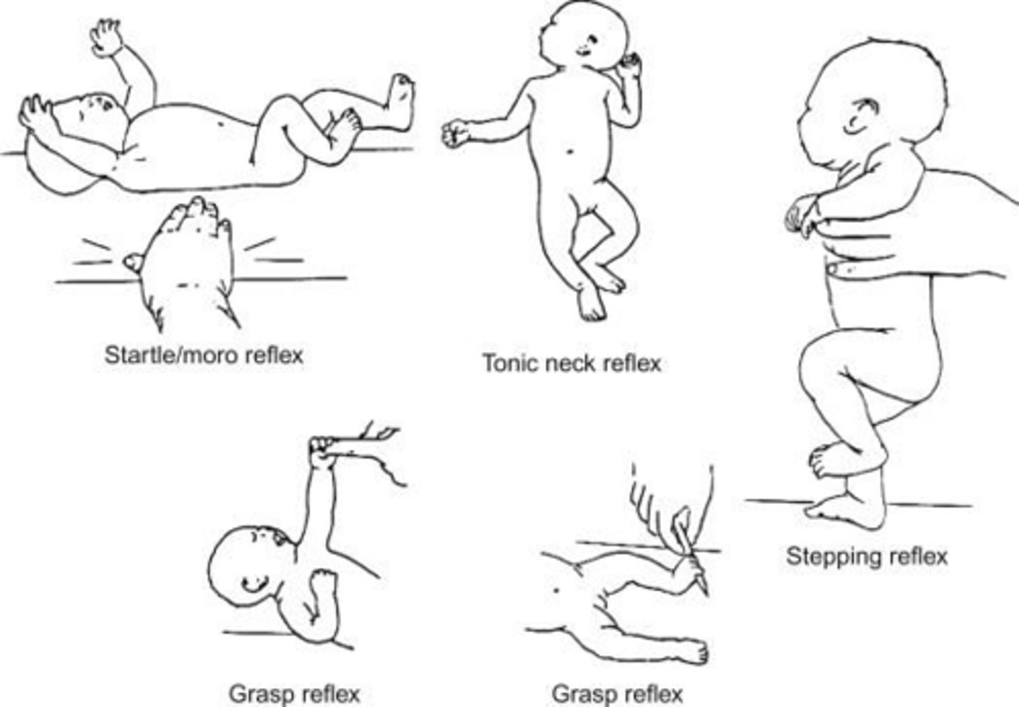 <p>Palmar grasp, Moro reflex, Babinski reflex, plantar grasp, stepping reflex, tonic reflex, and sucking/rooting reflex.</p>