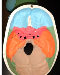 <p>What is this bone (pointed at the dip to the left region)?</p>