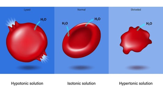 <p>Hypertonic</p><p>Isotonic</p><p>Hypotonic</p><p></p>