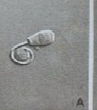 <p>What is this? Normal or abnormal sperm?</p>