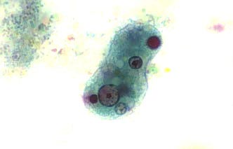 <ul><li><p>used for fresh and PVA-preserved stool</p></li><li><p>shows blue-green cytoplasm and red-purple nuclei</p></li><li><p>eggs and larvae appear red</p></li></ul><p></p>