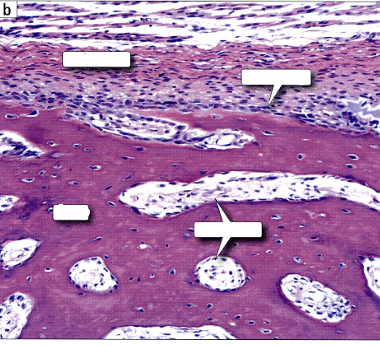 <p>identify type of bone</p>
