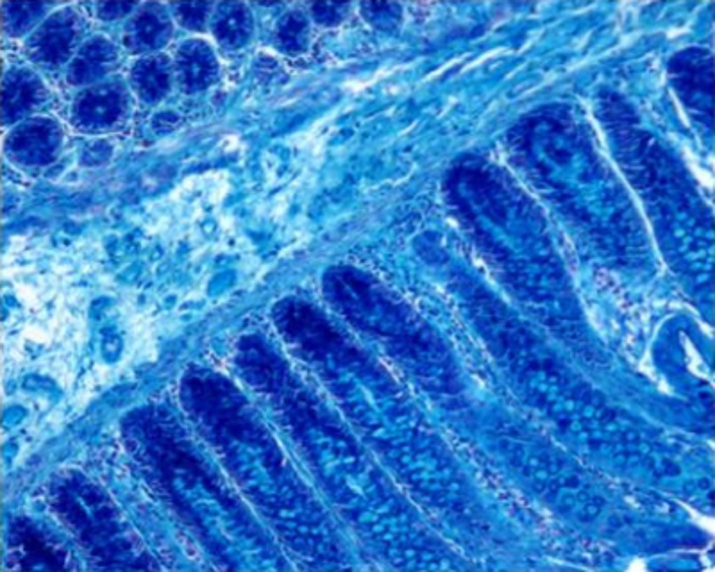 <p>lack of properly acidified solution</p><p>Feedback:</p><p>The colloidal iron solution must be acidified to a pH if between 1.5-1.9. The Mueller colloidal iron solution does not require dialyzing and is the solution most frequently used today.</p>