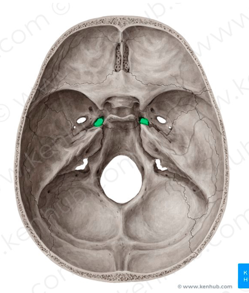 <p>A bony passageway in the sphenoid bones of the skull that connects the eye socket to the middle cranial fossa</p>