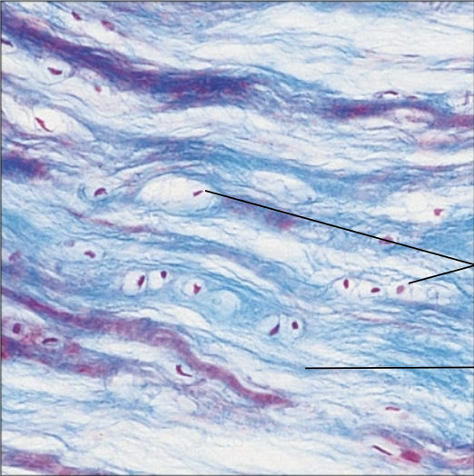<p>What cartilage?</p>