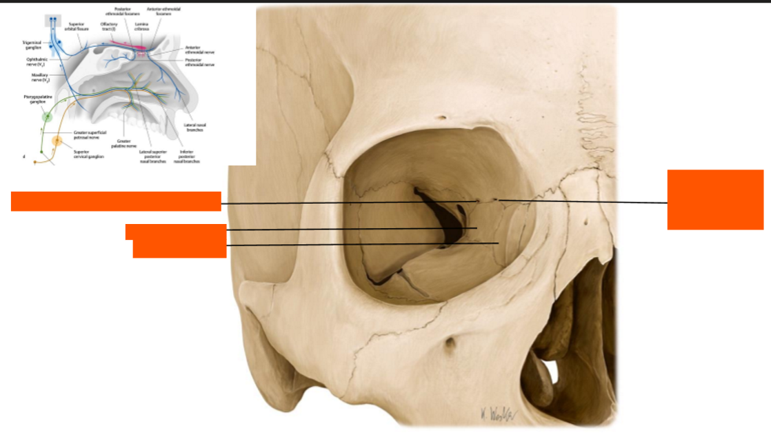 <p>Label this diagram of the skull</p>
