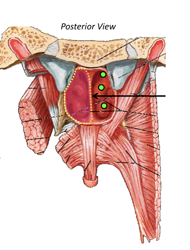 <p>Nasal Chochae</p>