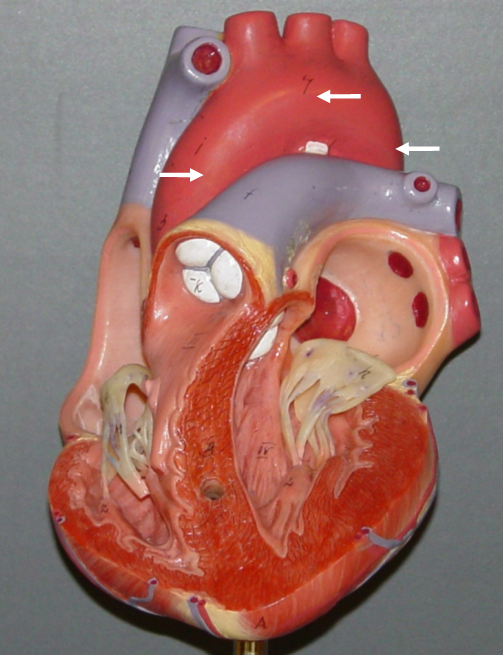 <p>– Ascending aorta</p><p>– Arch of aorta</p><p>– Descending aorta</p><p>• Carries oxygenated blood from the left ventricle</p><p>– To the body</p>