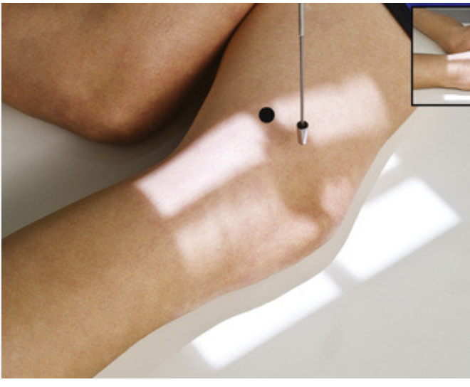 <p>Patient will be in a lateral recumbent position with the affected side down, flex knee 5-10 degrees and make sure the body and knee are in a true lateral position. </p><p>CR is perpendicular to IR.</p>