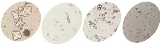 <p>what crystal is this? is it alk or acid?</p>