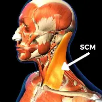 <p>sternocleidomastoid </p>