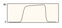 <p>1. opioid OD</p><p>2. malignant hyperthermia </p><p>3. seizures </p><p>đź’ˇthis capnograph shows hypercarbia & yes, all answer choices can cause hypercarbia BUT notice that the waveform returns to baseline, which rules OUT rebreathing </p><p>-causes of rebreathing = incompetent unidirectional valve, exhausted soda lime, & hole in inner tubing of Bain circuit </p><p>đź’ˇMH & seizures are hypercarbia due to CO2 ober production & hypercarbia from opioid OD is from reduced CO2 clearance</p>