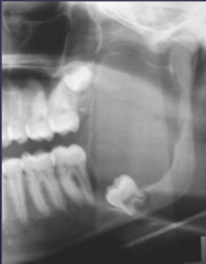 <p>Describe the characteristics of this lesion: (5)</p>