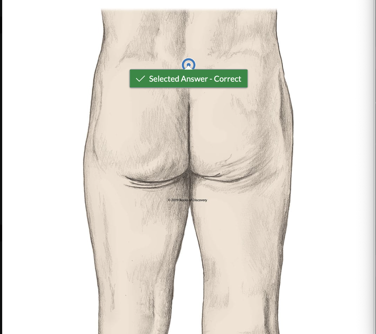 <p>Using hot spot technology identify where the sacrum is located</p>