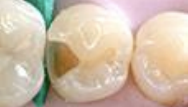 <p>What caries are shown? </p>