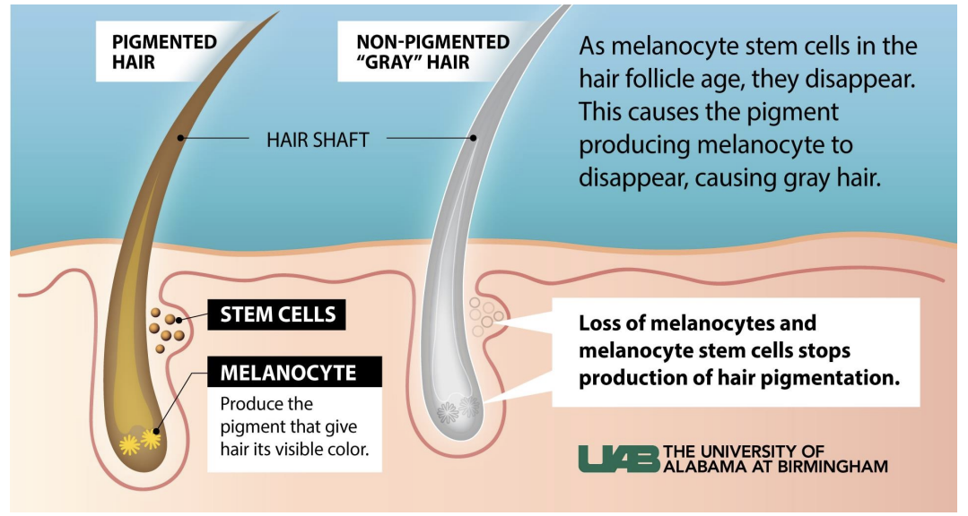 <ul><li><p>Skin has different types of stem cells</p><ul><li><p>Hair follicle stem cells (<strong>HFSC</strong>) sustain hair growth</p></li><li><p>Epidermal stem cells replenish skin</p></li><li><p>Melanocyte stem cells generate pigment producing cells</p></li><li><p>Dramatic reduction in melanocyte stem cells numbers with age – visible effect in people</p></li><li><p><strong>HFSC</strong> – <strong>DNA</strong> <strong>damage</strong> causes loss of stem cell and eventually <strong>loss</strong> <strong>of</strong> <strong>hair</strong> <strong>follicle</strong> <strong>entirely</strong></p></li></ul></li></ul><p></p>