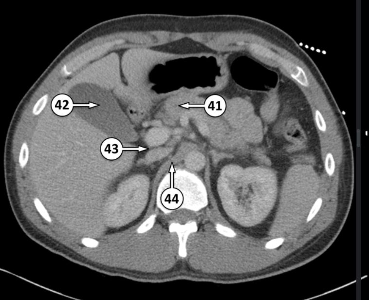 <p>Label 41 and 42</p>