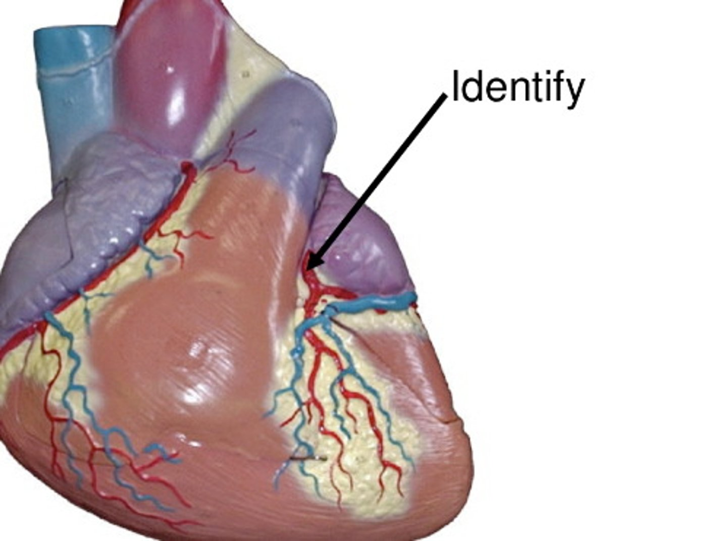 <p>left coronary artery</p>