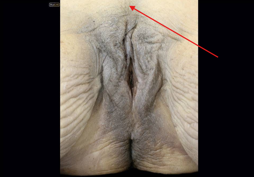 <p>Identify</p><p>Side Question:</p><p>Neurovascular Supply?</p>