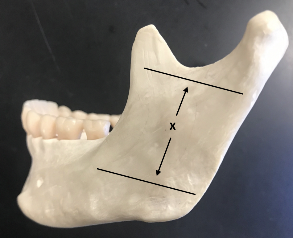 <p><span>Identify the structure labeled "X"</span></p>
