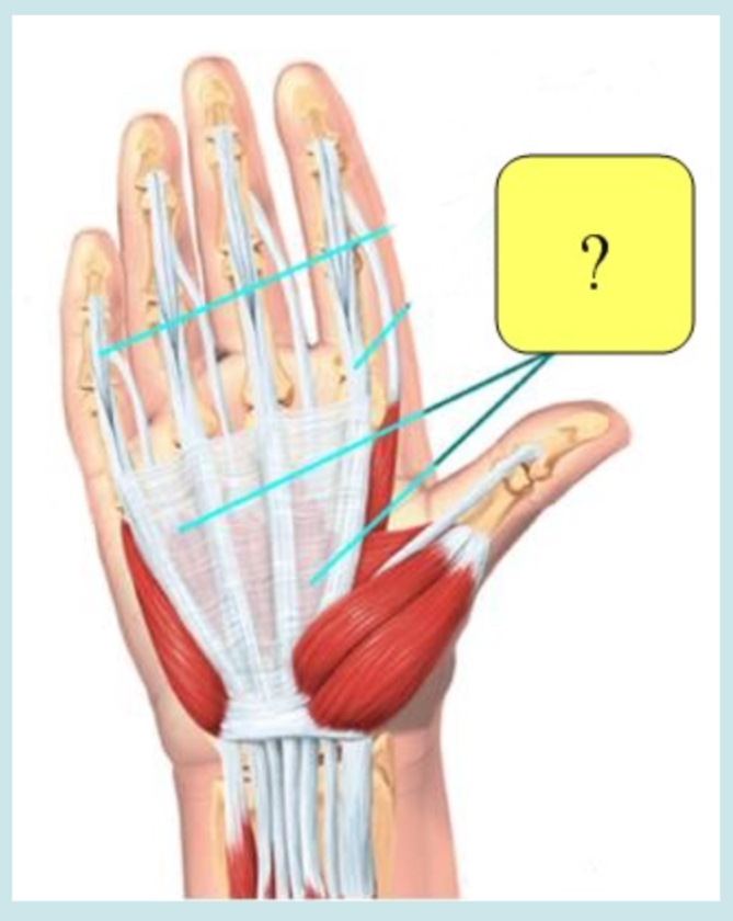 <p>ID this structure of the hand</p>