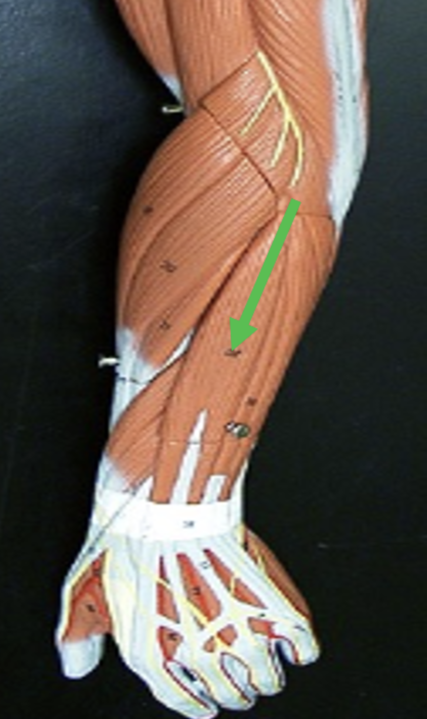 <p>Identify the muscle indicated by the pointer.</p>
