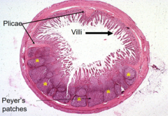 <p>GALT (Gut-Associated Lymphoid Tissue)</p>