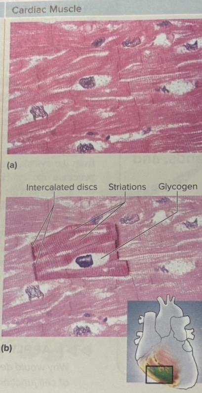 <p>where is cardiac muscle tissue found</p>