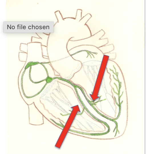 <p>Located along left and right sides and receives signal from the AV bundle and send it down to the apex of the heart. Sends electrical signal to the left and right ventricular walls </p>