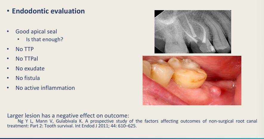 <ul><li><p>Apical seal</p></li><li><p>Not TTP</p></li><li><p>Not TTPal</p></li><li><p>No exudate, fistula, active inflammation</p></li></ul><p></p>