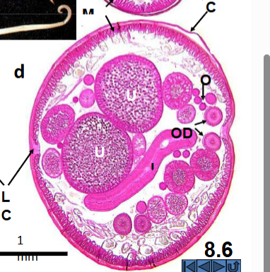 <p>What is labeled at LC?</p>
