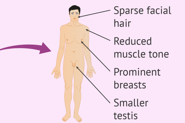 <ul><li><p>Trisomie 2n+1</p></li><li><p>47, XXY</p></li><li><p>affecte le développement physique et cognitif </p></li><li><p>faible taux de testosterone </p></li><li><p>Infertilité </p></li><li><p>une grande taille</p></li></ul><img src="https://assets.knowt.com/user-attachments/3b963c21-3c04-4cbb-a65c-4503f6273c73.png" data-width="100%" data-align="center"><p></p>