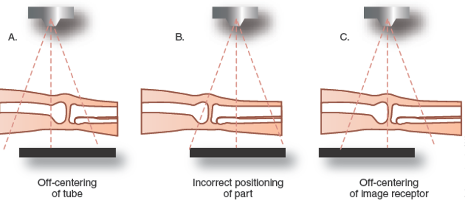 <p>Incorrect Centering</p>