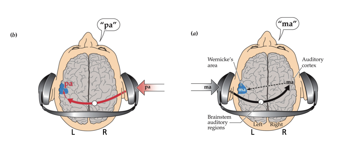 <p><strong>Crossed Auditory Pathways</strong></p><ul><li><p><span><strong>Left ear → right hemisphere</strong></span></p></li><li><p><span><strong>Right ear → left hemisphere</strong></span></p></li></ul><p><span>This crossing is shown by the colored pathways</span></p><p><strong>Left Hemisphere Language Dominance</strong></p><ul><li><p><span>Wernicke’s area (shown in the left hemisphere) processes language.</span></p></li><li><p><span>Because the <strong>right ear projects directly to the left hemisphere</strong>, people usually report the <strong>right‑ear sound</strong> first or more accurately.</span></p></li></ul><p><span>This is called the <strong>right‑ear advantage</strong>.</span><br><span><strong>Meaning the left hemisphere is dominant for language</strong></span></p>