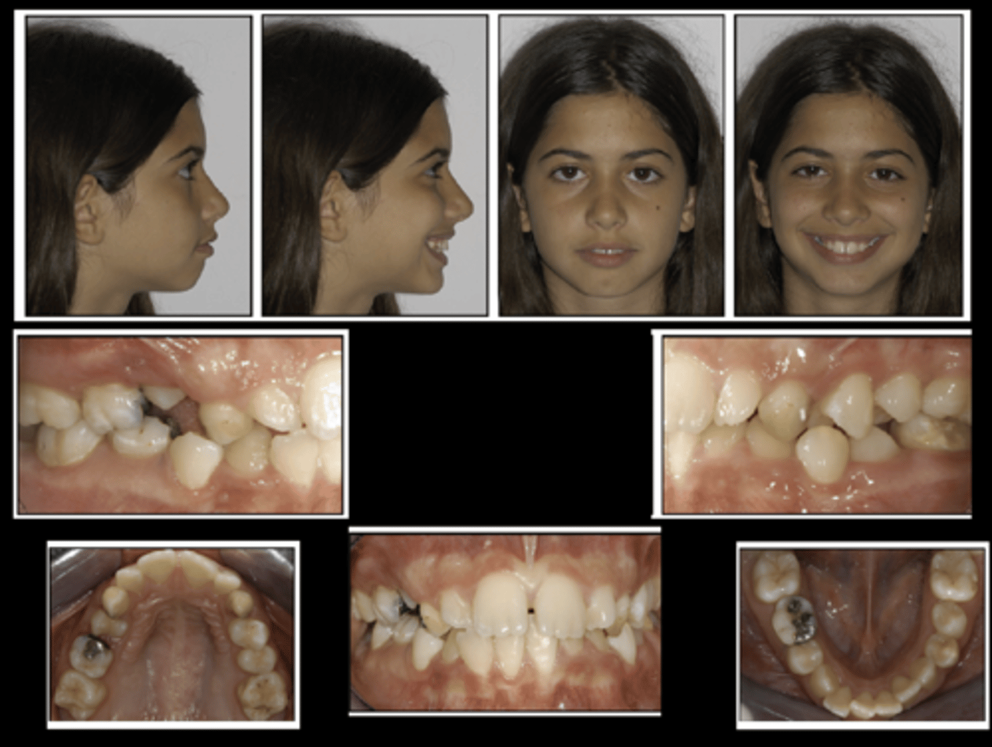 <p>What are some treatment objectives for this case?</p>