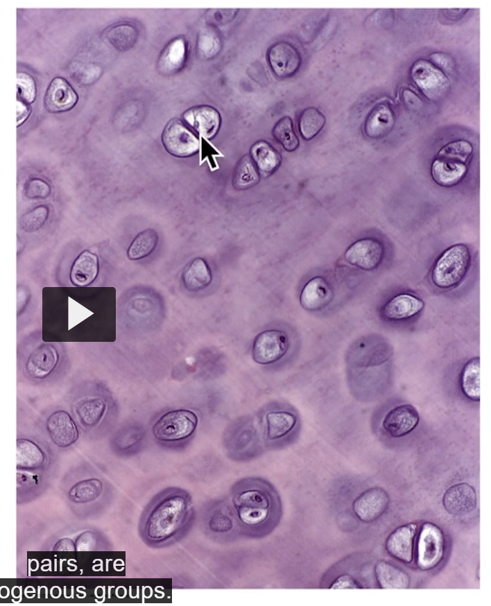 <p>Observe the chondrocytes in their lacunae. These chondrocytes are in pairs, are isogenous groups. Observe territorial matrix surrounding groups and come from the same cellular division. </p><p>Remember if I wish to see chondrocytes or mature chondrocytes, I have to go near the perichondrium area. </p>