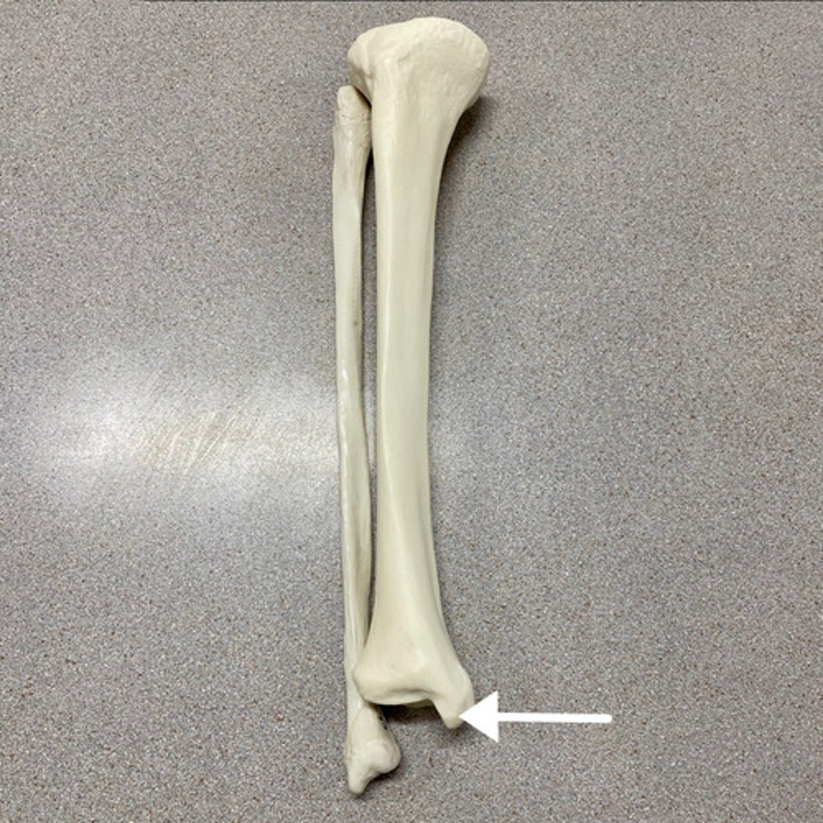 <p>What is this?</p>