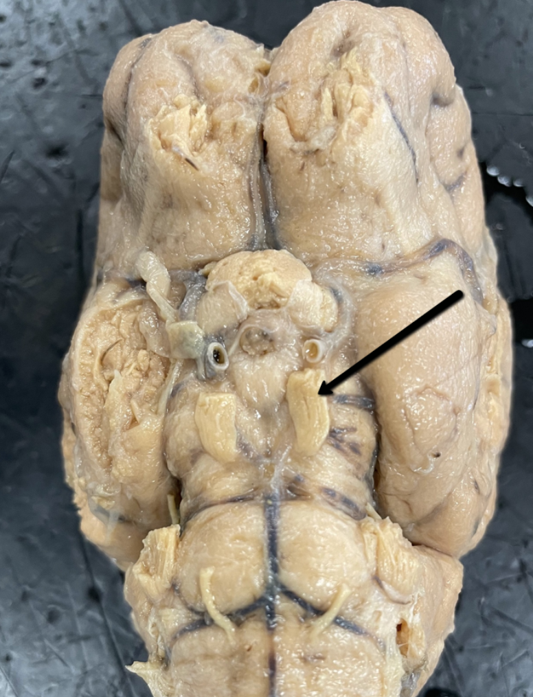 <p><span>Identify the cranial nerve indicated by the pointer.</span></p>