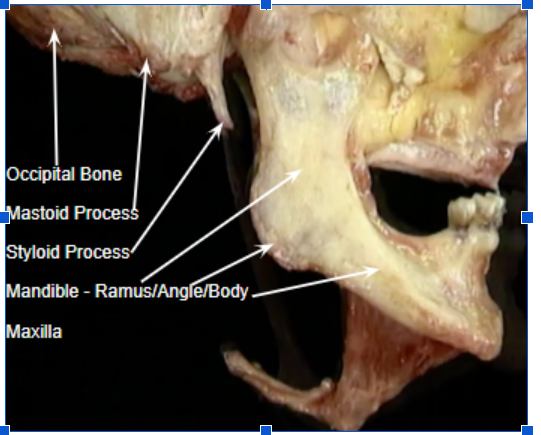 <p>Thing sticking out: hyoid bone</p><p>Jaw bone: mandible</p><p>A little in front of the mandible (no arrow): body</p><p>Back of mandible: angle</p><p>“Top stem” of mandible: ramus</p><p>Pointy thing that is high: styloid process</p><p>Behind the styloid process: mastoid process</p><p>Muscle: mylohyoid muscle</p><p></p>