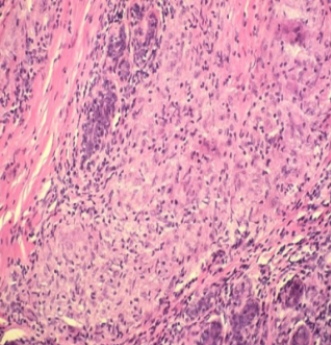 <p>What pathology? </p>