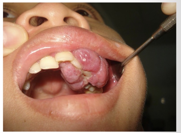 <p>CHẨN ĐOÁN?</p>