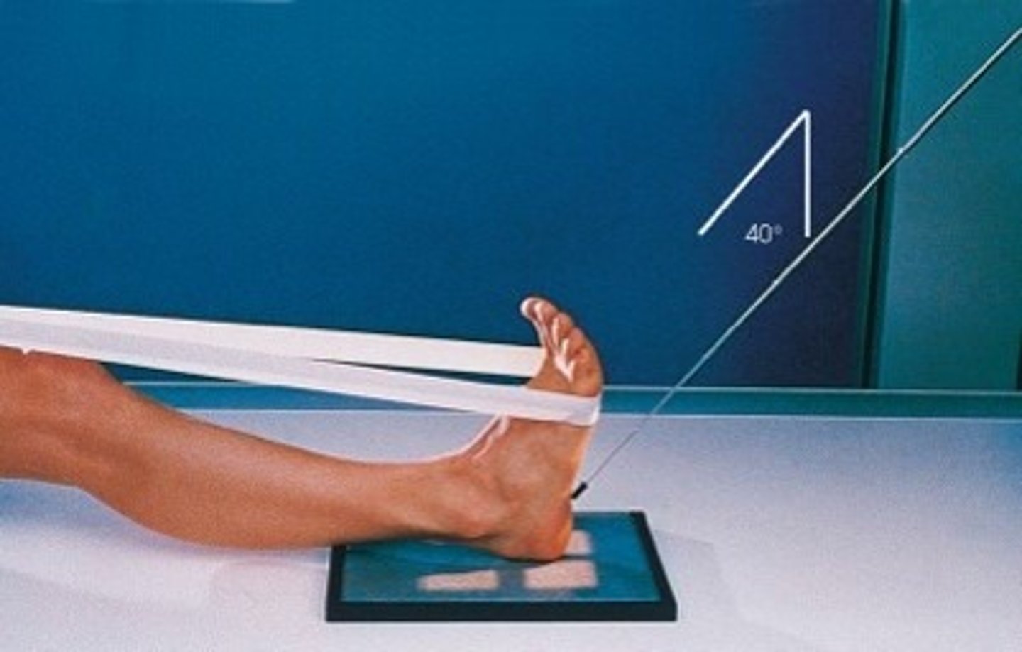 <p>S - on lap</p><p>T - 16 mAs @ 65 kVp</p><p>A - 40 degree cephalic</p><p>M - correct foot, on cassette</p><p>P - pull toes back, CR to 3rd metatarsal</p><p>S - 40"</p><p>B - hold</p><p>C - 10 x 12, L</p>