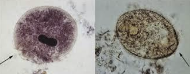 <p>What species causes balantidiasis and is zoonotic, transmitted by ingestion of cysts, and producing watery-mucoid diarrhea or intestinal hemorrhage in humans? In pigs, it causes mild-severe enteritis and diarrhea, and diagnosis is with fecal floatation or direct smear. Treatment is with metronidazole and tetracycline.</p>