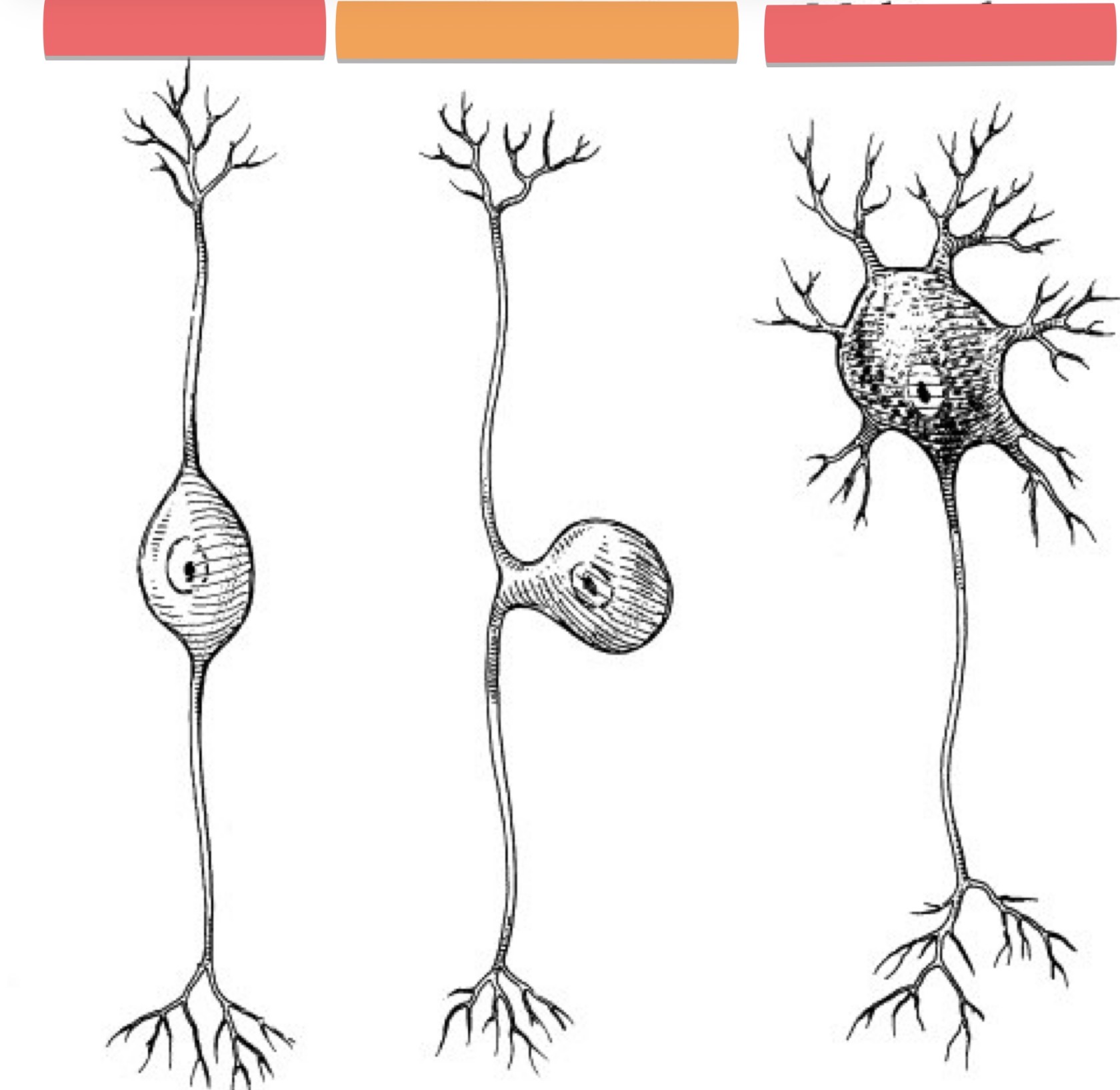 <p>What Neuron is this?</p>