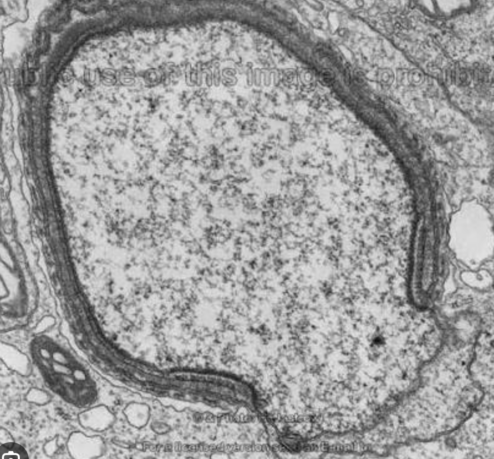 <p>Appears as a double-membrane boundary that surrounds the cell nucleus</p>