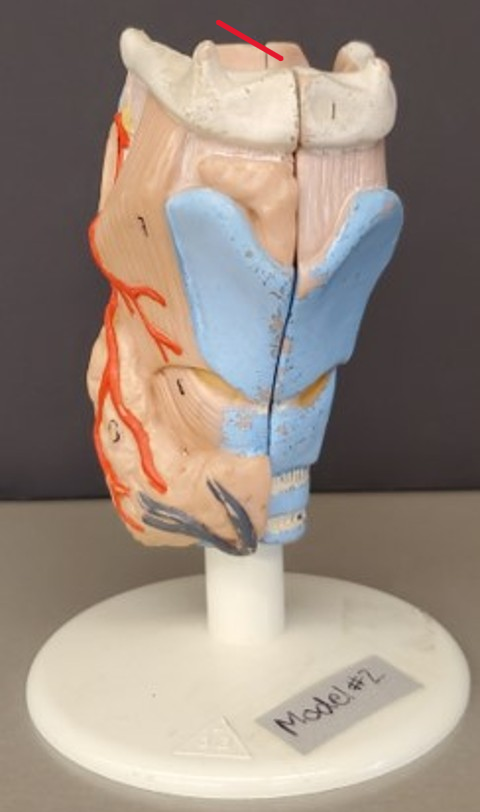 term image
