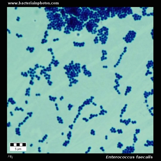 <p><u>Cell morphology</u>: <strong><mark data-color="yellow" style="background-color: yellow; color: inherit;">diplo/streptococci</mark></strong></p><p>4) <u>Gram-stain</u>: <span style="color: green;"><strong><mark data-color="purple" style="background-color: purple; color: inherit;">positive</mark></strong> </span>(purple)</p>