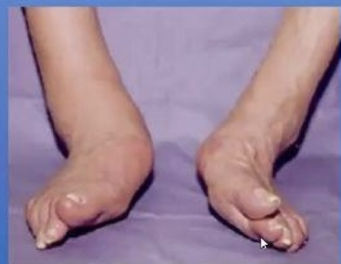 <p>What is the name and cause of this image </p>